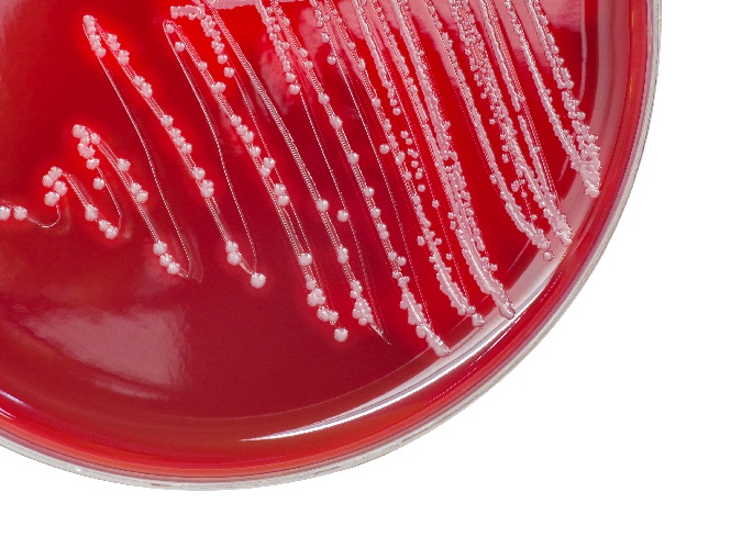 Re-thinking the causes of rheumatic fever