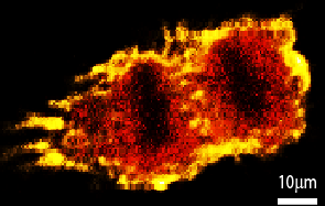 Chasing a cancer suspect to cytokinesis