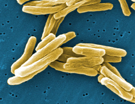 New Zealand TB drug candidate selected (2012)