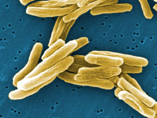 Modern approaches to an ancient disease (2010)