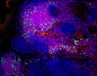 Lighting up lymph nodes (2009)